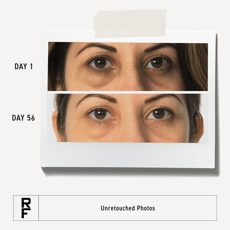 RODAN + FIELDS Active Hydration Bright Eye Complex | 15ml