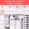 ECG RULER Pocketcard - Transparent EKG Calipers 7 Step Ruler