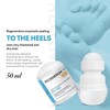 Regenerative Enzymatic Heel Peeling - Dissolves Thickened Skin & Calluses