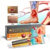 Scar Cream for Pressure Points, Soothing Cream for Pressure Points,