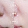 Anacis 리더미스 속건조 해결 판테놀 수분 로션 크림 앰플 3종