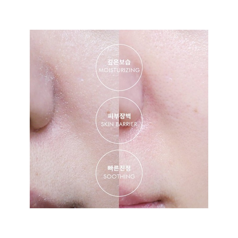 Anacis 리더미스 속건조 해결 판테놀 수분 로션 크림 앰플 3종