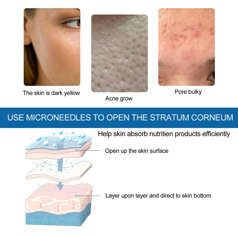 10pcs Microblading Micro Needle Electric Skin Rejuvenation Micro Needle Machine