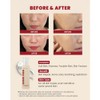 KSECRET [KSECRET]SEOUL 1988 Essence : Snail Mucin 97% + Rice
