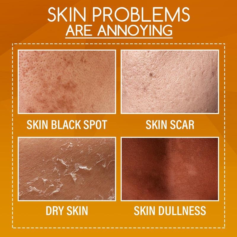 Orange Peeling Lotion, 3 Counts/set Gentle Exfoliating Body Lotion, Moisturizing