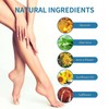 NYYQYYN Varicose Veins Treatment for Legs,Varicose Veins Treatment Cream-Improves Blood