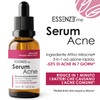 Serum Acne Essenze.me - Trattamento Anti-Acne Veloce, Elimina Brufoli e