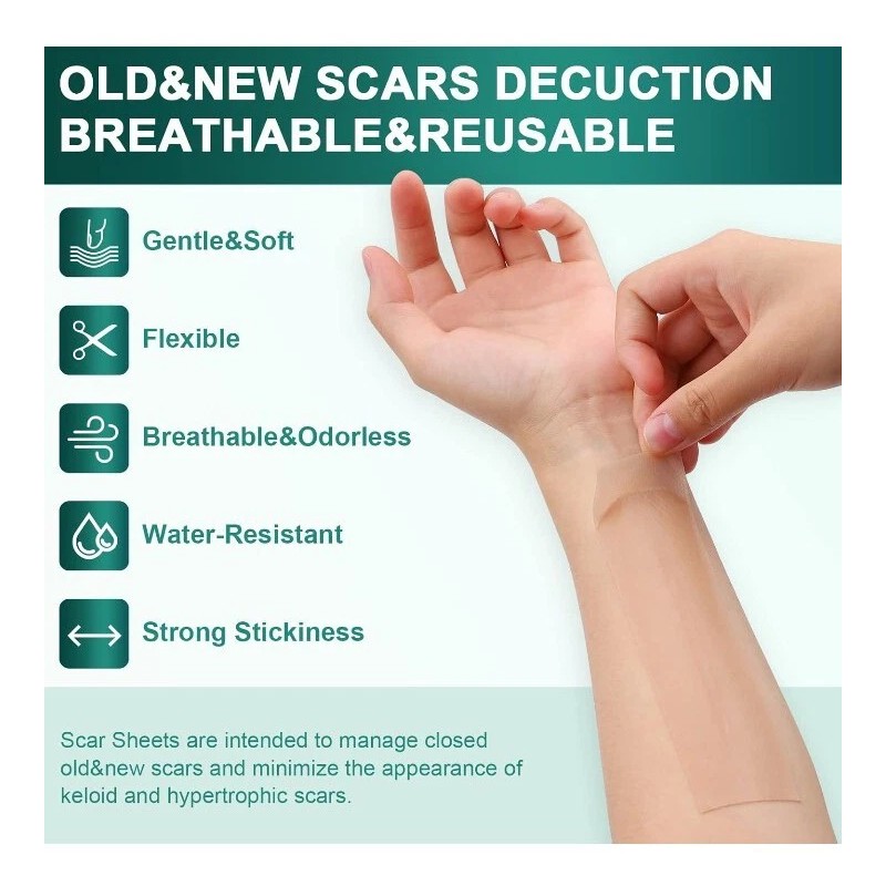 Airroye 1 Roll Silicone Adhesive Scar Sheets 1.6" x 120