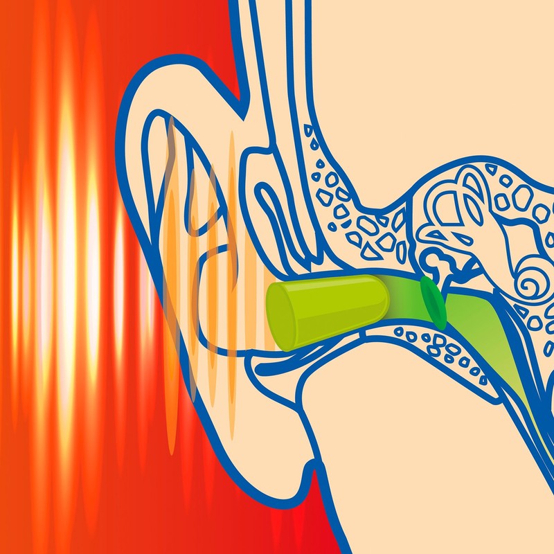 Sanohra Max Adults with Earplugs 37 SNR Noise Isolation, Pack