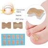 77 Pieces Ingrown Toenail Tool Set, Include Ingrown Toenail File