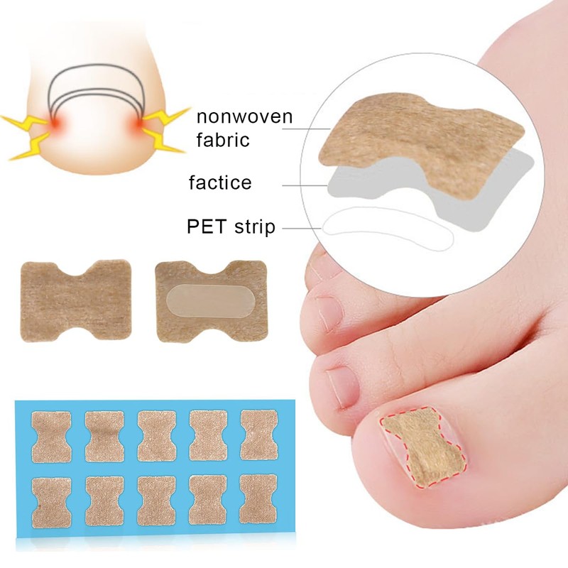 77 Pieces Ingrown Toenail Tool Set, Include Ingrown Toenail File