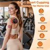 cotsoco Original 5-in-1 Cupping Kit for Massage Therapy, 20 Suction