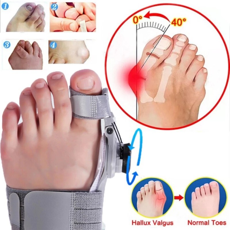 2PCS Hallux Valgus Bunion Corrector Orthopedic Adjuster Brace Foot Toe