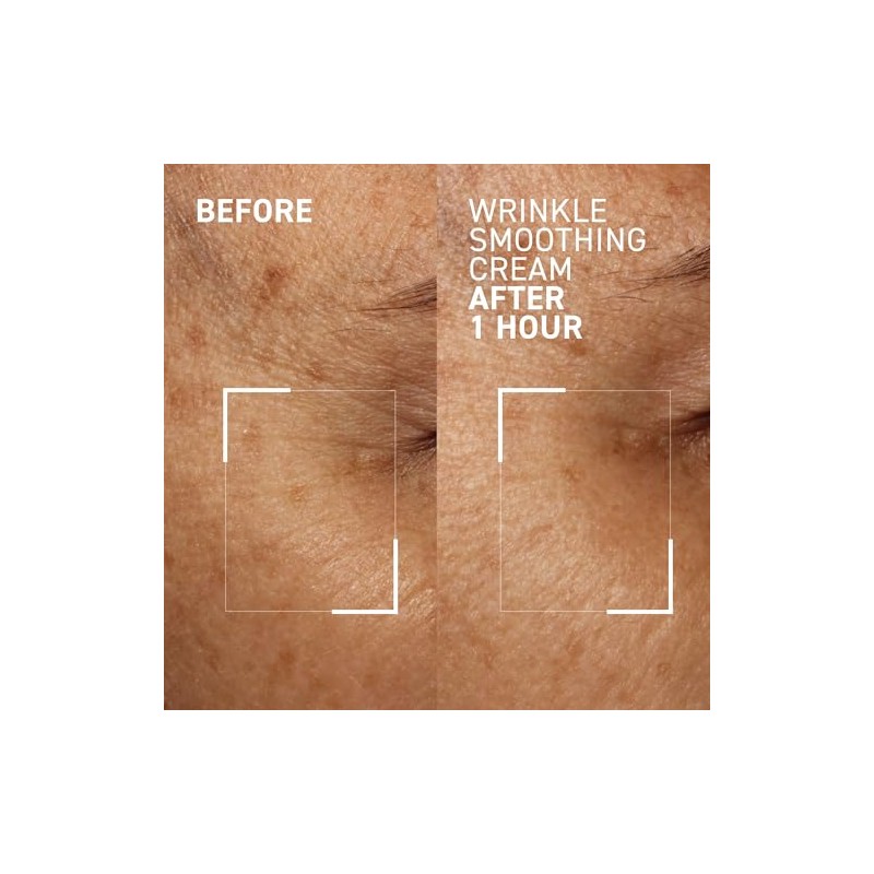 Dr. Brandt Needles No More Wrinkle Smoothing Cream, 0.5 Fl.