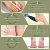 Foot File Double Sided Callus File Foot Care Callus Rasp