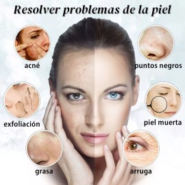 Ezzyso Limpiador Ultrasónico Scrubber Facial Skin Peeling Portatil