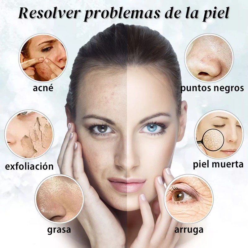 Ezzyso Limpiador Ultrasónico Scrubber Facial Skin Peeling Portatil