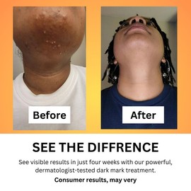 Buy Glow Wash +FREE Turmeric Pads Beauty Kit