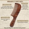 Honeydak Dandruff Comb, Hollow Tooth Button Scalp Psoriasis Multifunctional Lice