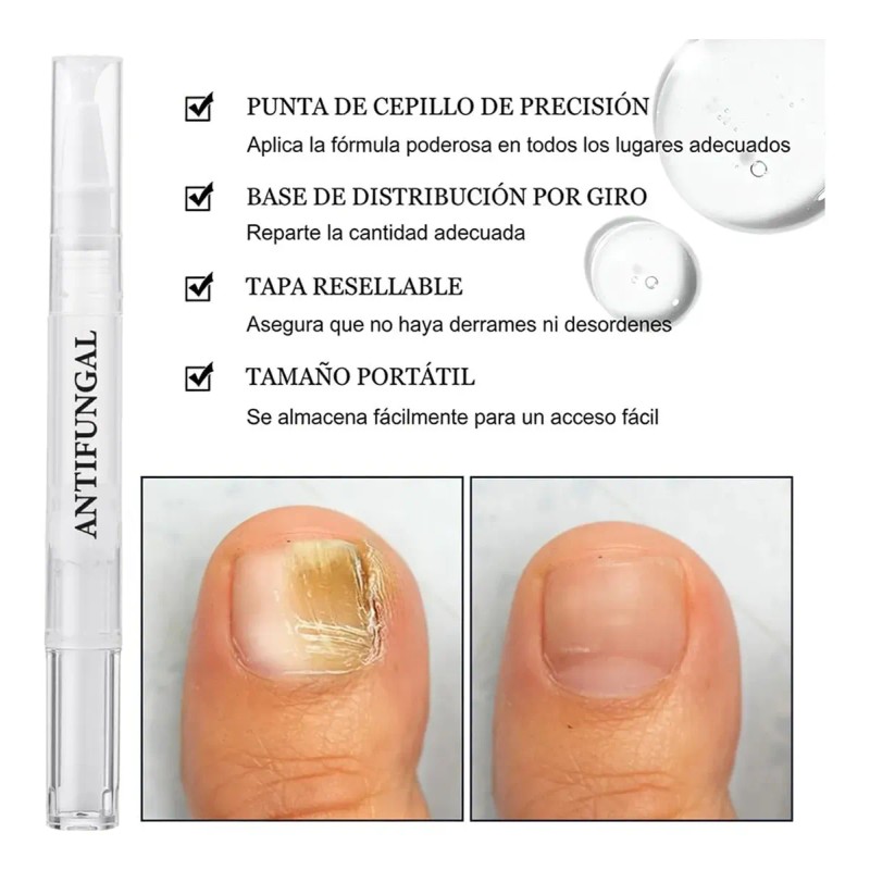 Seralia Lápiz Antihongos 3 Unids, Cuidado Cosmético Uñas /