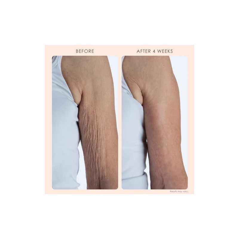 Crépe Erase Advanced – Advanced Body Repair Treatment with Trufirm
