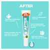 Duopack Repelente de Mosquitos 1 Repelente Prevent Gel 150ml +
