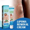 Relieve subcutaneous lumps caused by lipoma-fat cream