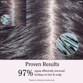 Rizos Curls Rizos Curls Apple Cider Vinegar Scalp & Hair Rinse, Clarifies to Remove Product Buildup, Balance Oils, Revive Hair & Scalp, Enhances Softness & Shine, 10 oz