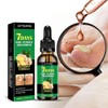 Ginger Nail, Tratamiento de Uñas con Jengibre, Soporte para Uñas,