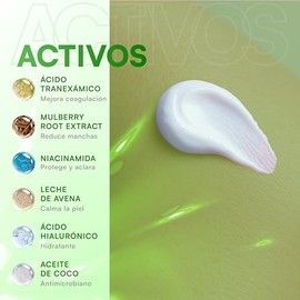 MIST JEWEL - CLEAR - Crema Corporal Desmanchante e Hidratante Perfect Pigment con cido Tranexmico y Mulberry  Desvanece Manchas, unifica el tono y... 