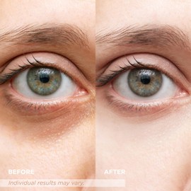 VELAMO ADVANCED VELAMO ADVANCED Luminous Eye Corrector SPF 41: Under Eye Color Corrector for Dark Circles, Fine Lines & Puffiness - Hydrating Anti Aging Eye Cream with Ceramides Complex - Medium, 0.34 FL OZ/10mL