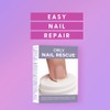 Orly Nail Rescue Kit
