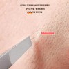 소형족집게 피부관리도구 인그로운헤어 제모족집게 트위저 뽑기 털 피지 피지뽑는핀셋 인그로운