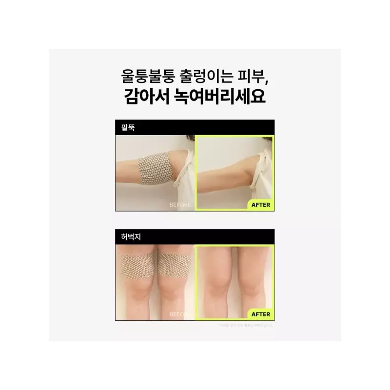 Dr. Ppeu 닥터빼 셀룰라이트 랩핑 패치 CELLULITE WRAPPING PATCH 2개