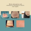 8 láminas de silicona para cicatrices de mama, de grado