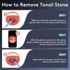 Tonsil Stone Removal Kit with Camera- 2025 Upgraded Tonsil Stone