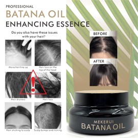 MEKERUI MEKERUI Batana Oil for Hair Growth 100% Pure | Traditional Cold-Pressed Method from Honduras | Scalp Treatment to Thicken Hair, Reduce Breakage & Frizz | 160g (5.6oz) for Men & Women