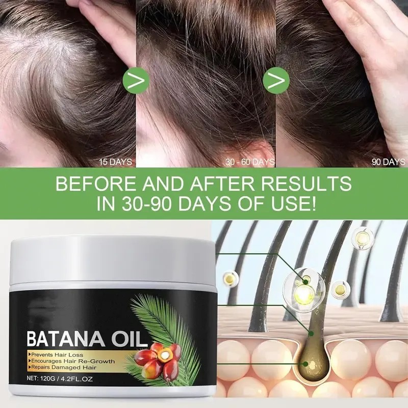 Aceite De Batana Orgánico Natural, Aceite Para El Cabello.