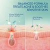 Crema Hidratante Cetaphil Para Acné Pieles Grasas Efecto Ma