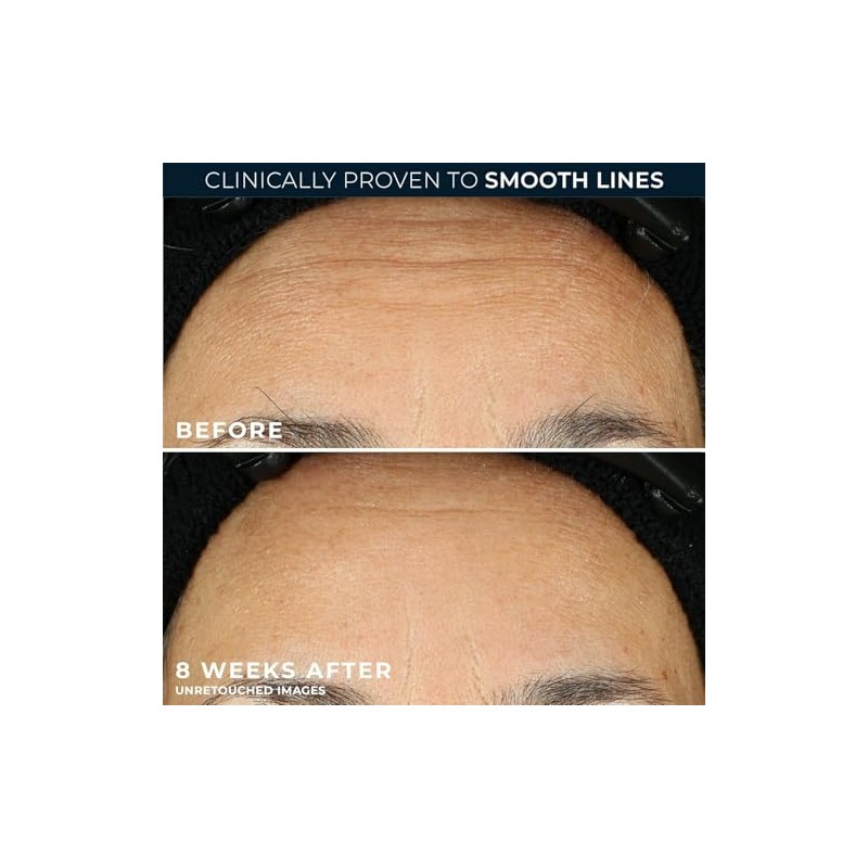 RoC Retinol Correxion Line Smoothing Night Retinol Serum, 30 Capsules