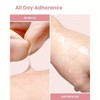 Acne Patches, 720pcs/set Acne Pimple Patches, Invisible Acne Patches, Pimple