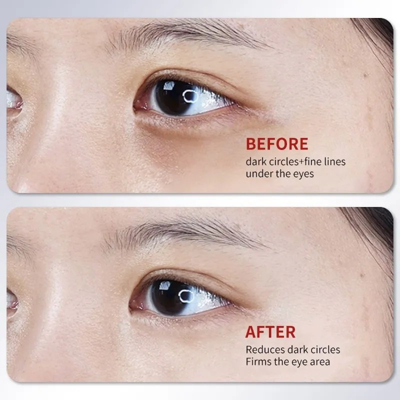 Fy Crema De Ojos De Café Hidratante E Hidratante.