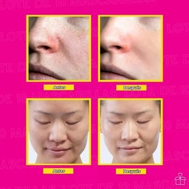 100 Mascarillas Coreanas Faciales Mayoreo Tipo De Piel Seca