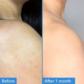 Good Molecules - Tratamiento corporal corrector de decoloración, 120 ml/4 oz, crema hidratante con ácido tranexámico, LHA y niacinamida para la hiperp