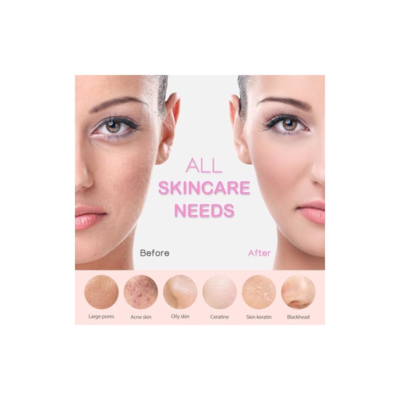 Rechargeable Silicone Facial Cleansing Brush with Heat Massage