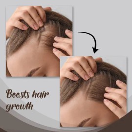 Sérum Para El Cabello Herstyler Con Aceite De Ricino Con Vit