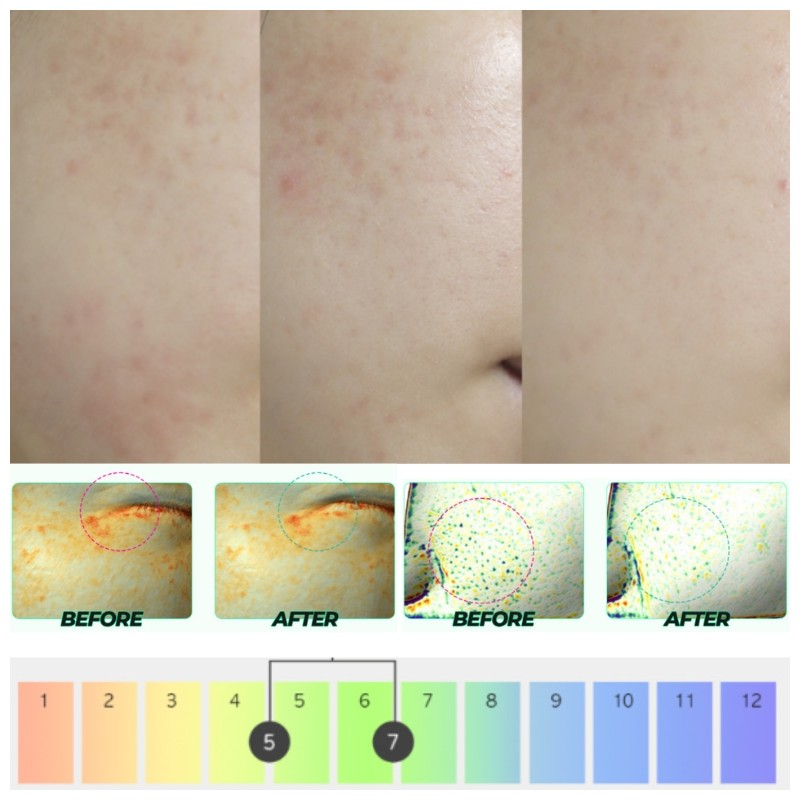 BRING GREEN Zinc Teca Blemish Serum 25ml