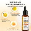 5X Batana Oil Serum Hair Growth For Healthier Thicker&Stronger Fuller