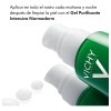Sérum Antiacné Normaderm Vichy 50 G Piel Grasa 2 Botellas
