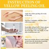 Peeling Oil for Dark Skin, Peeling Solution with Salicylic Acid,